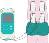 TensCare Perfect mamaTENS Szülési Fájdalomcsillapító Készülék